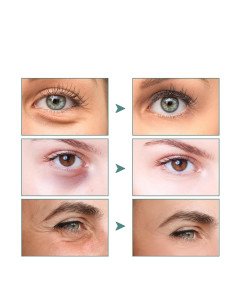 Baopinlady Jasmine Eye Cream Set 2 kosa 100 ml